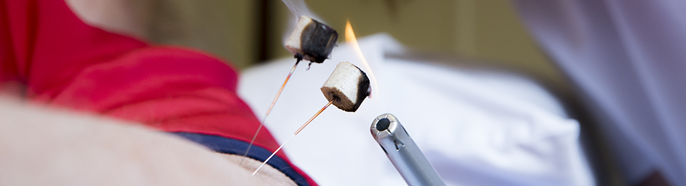 Hawley Health Centre - Acupuncture